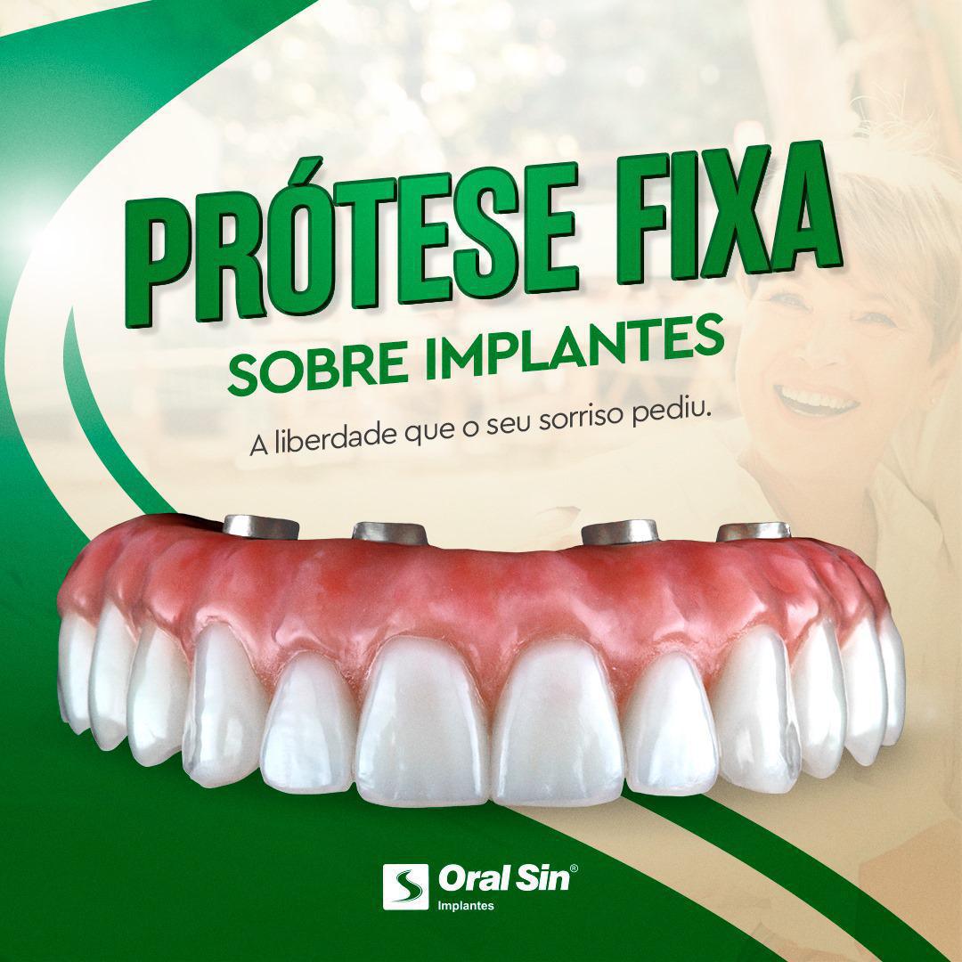 Oral Sin Implantes Clínica Odontológica