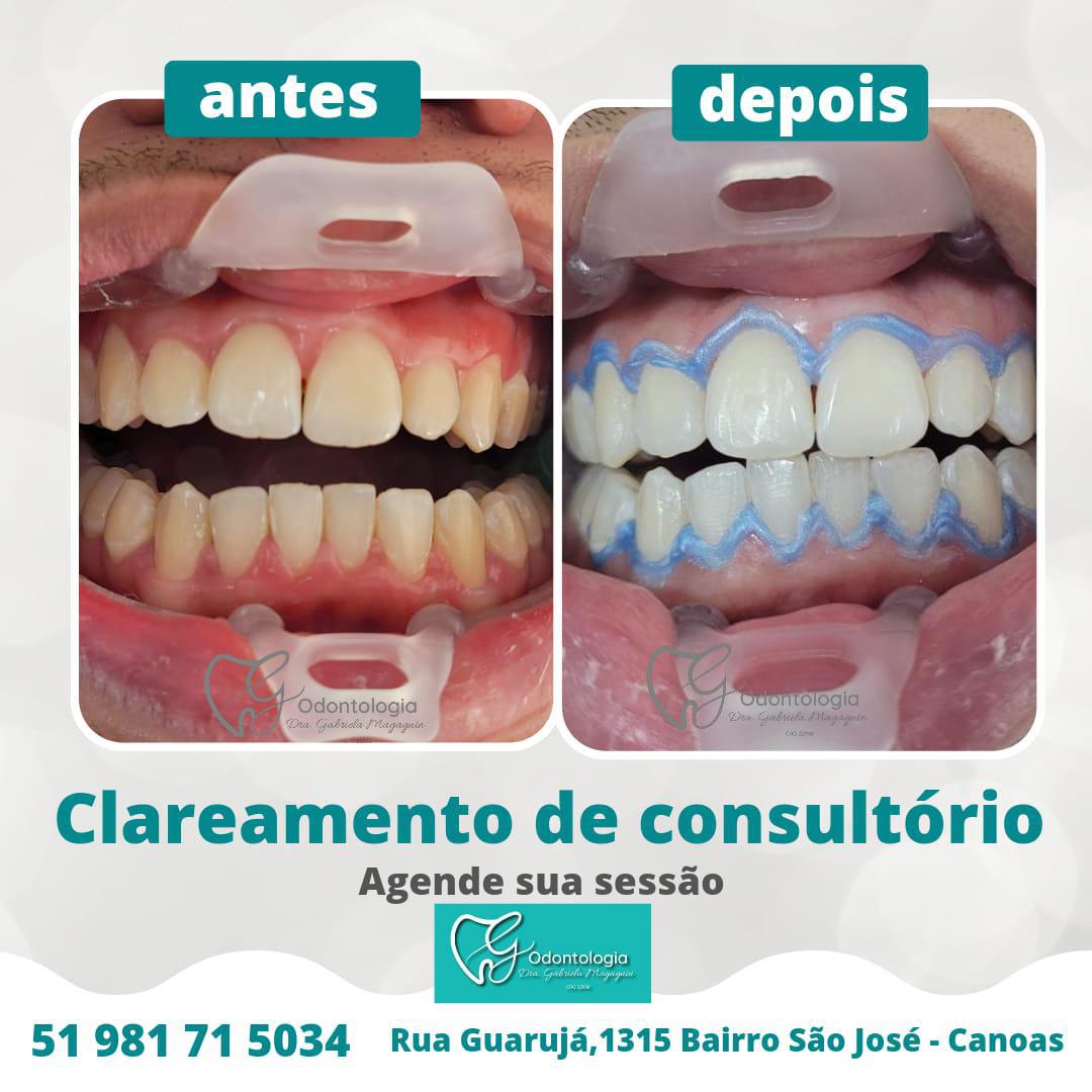 Odontologia - Dra Gabriela Magagnin