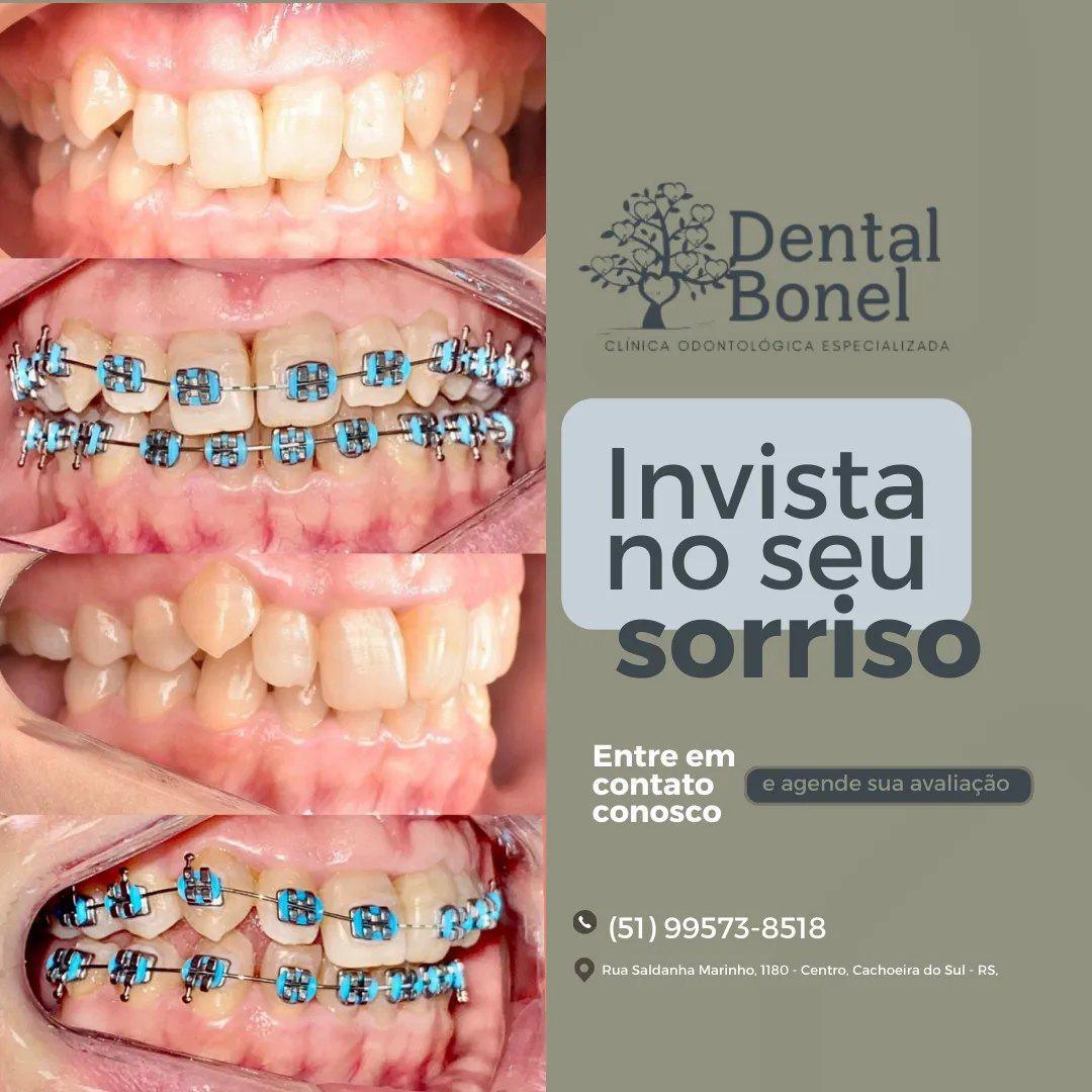 Clínica Dental Bonel