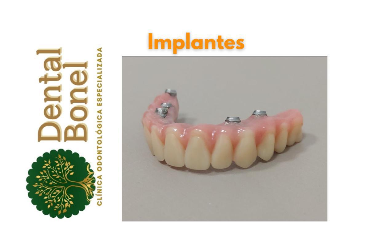 Clínica Dental Bonel