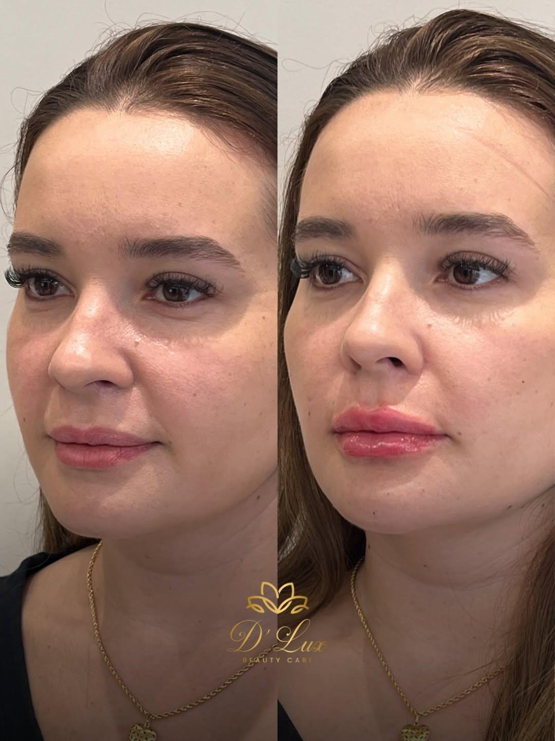 D' Lux | Beauty Care D' Lux | Beauty Care