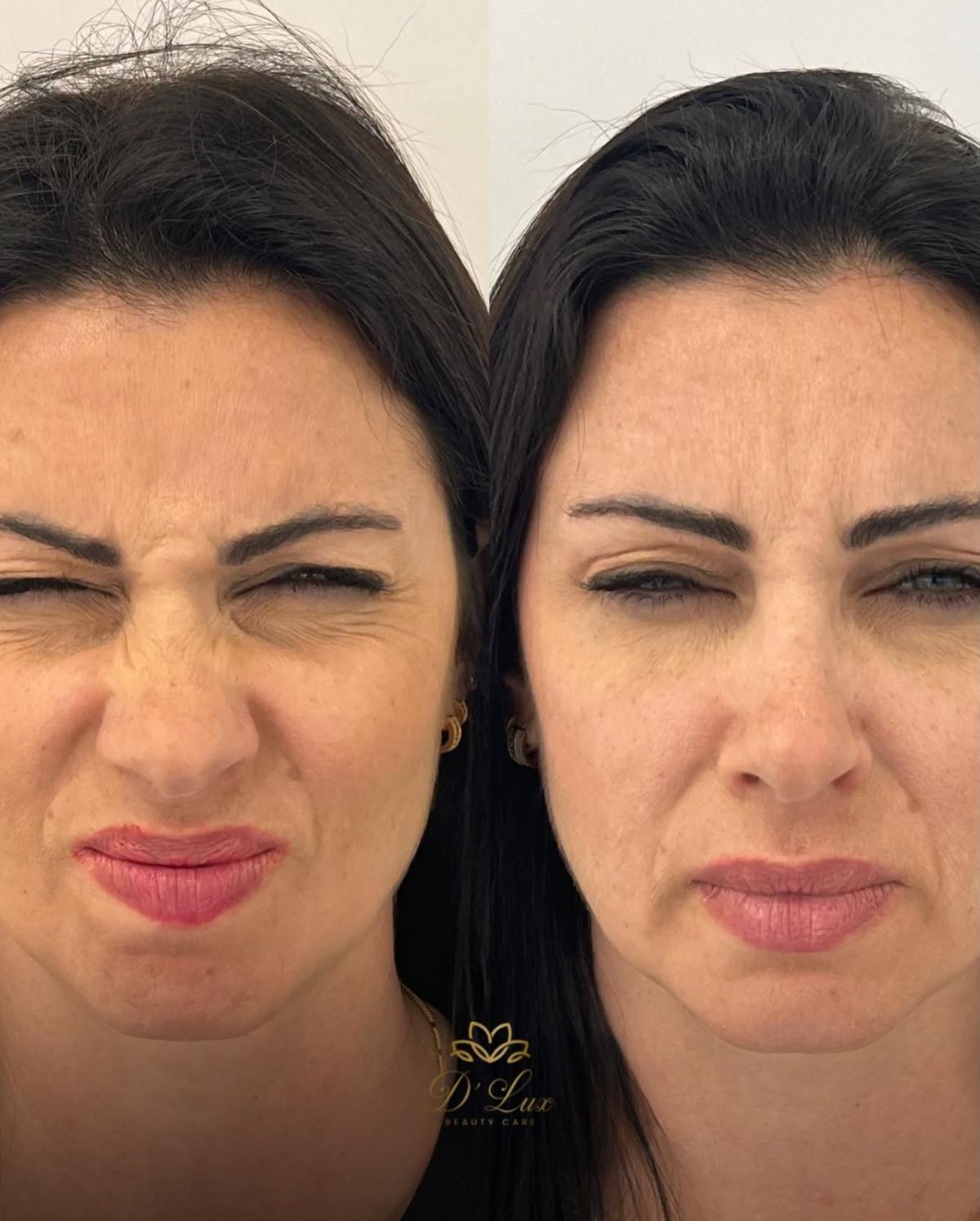 D' Lux | Beauty Care D' Lux | Beauty Care