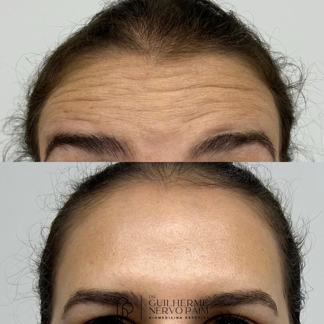 Dr. Guilherme Nervo Paim - Biomedicina Estética