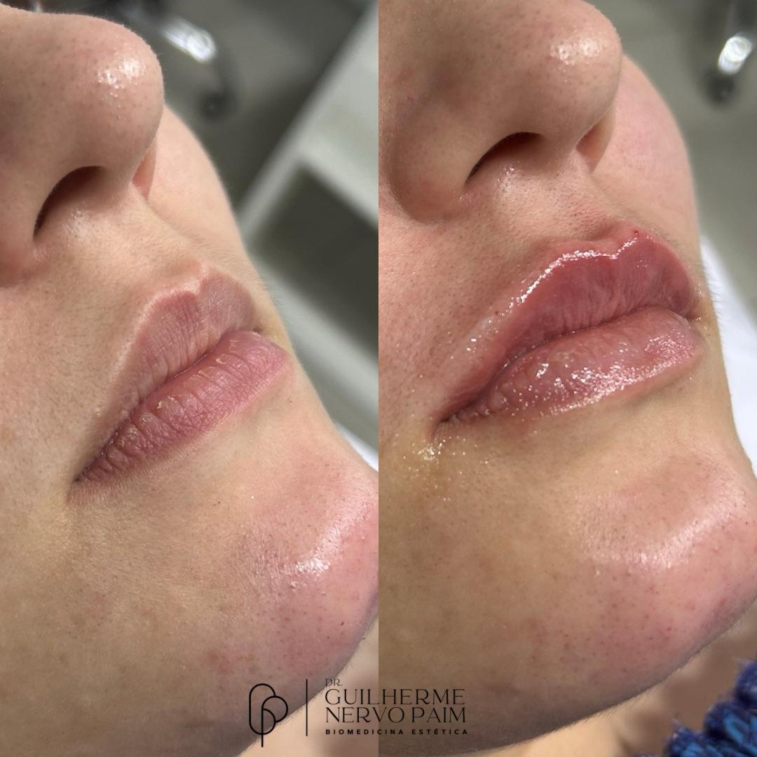 Dr. Guilherme Nervo Paim - Biomedicina Estética