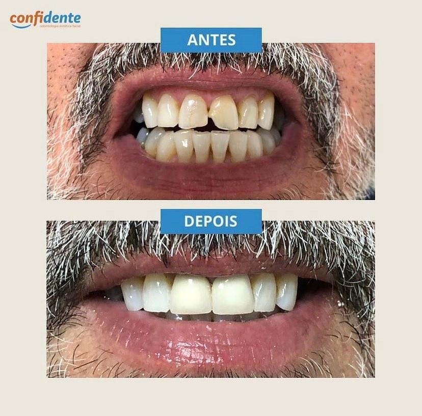Confidente Odontologia Confidente Odontologia