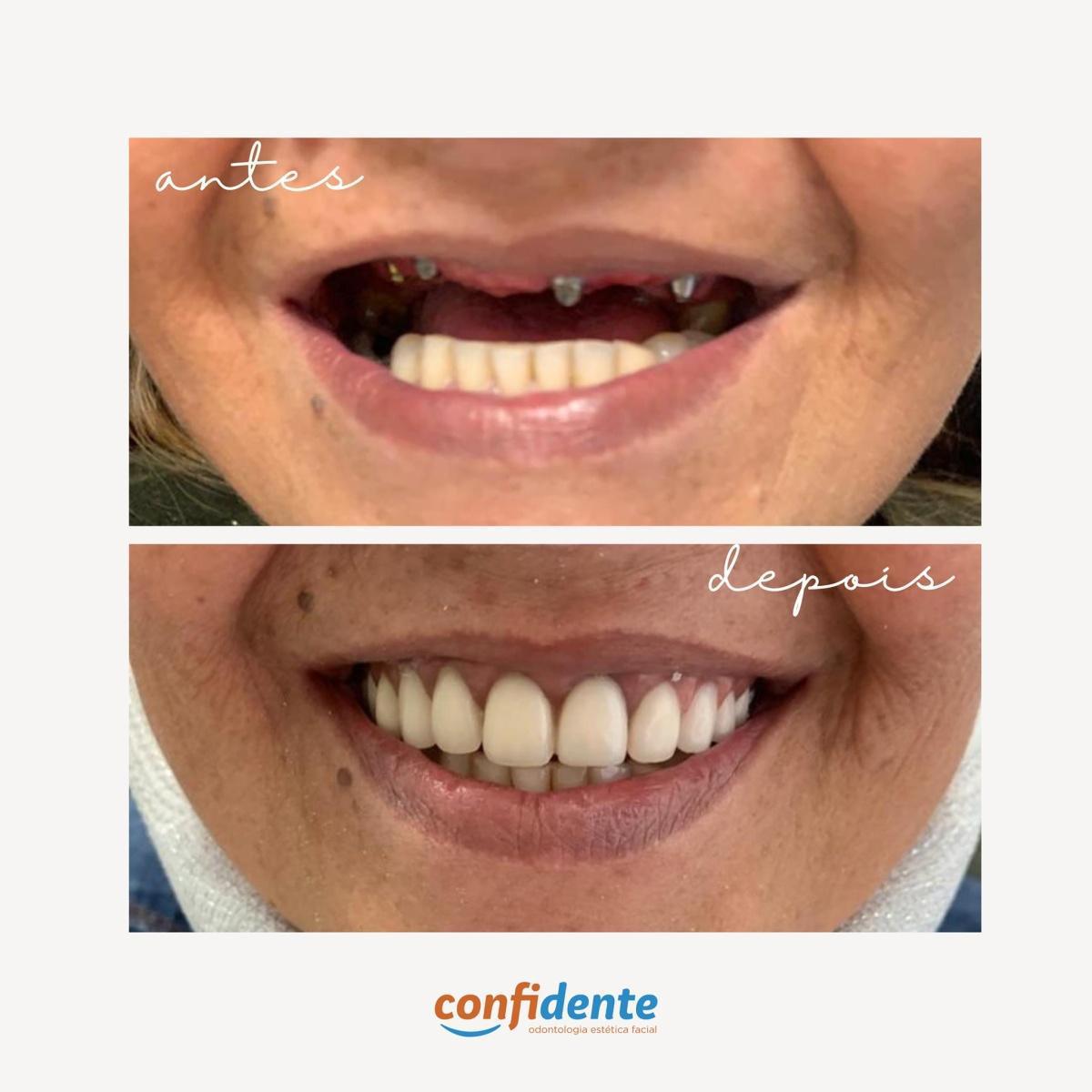 Confidente Odontologia Confidente Odontologia