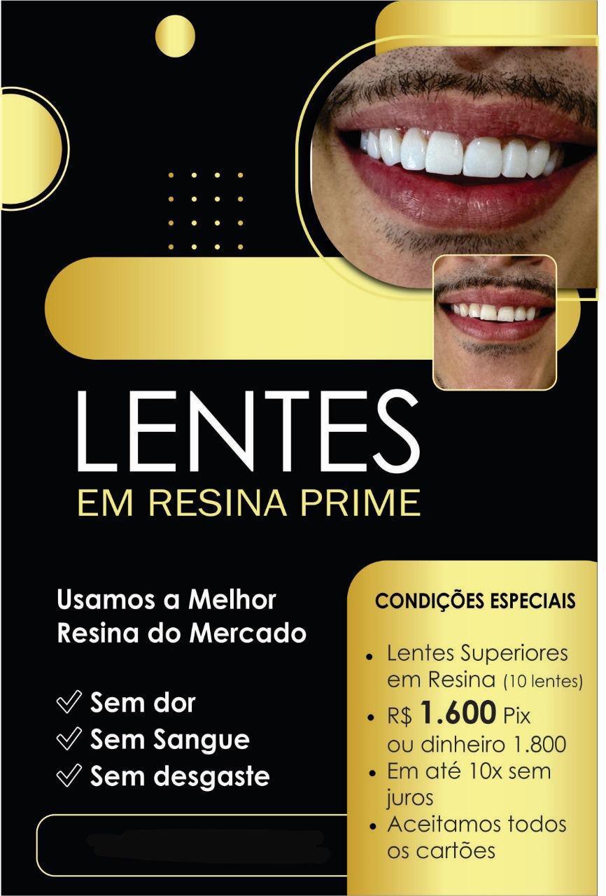  Lentes em Resina Prime por R$ 1.600,00