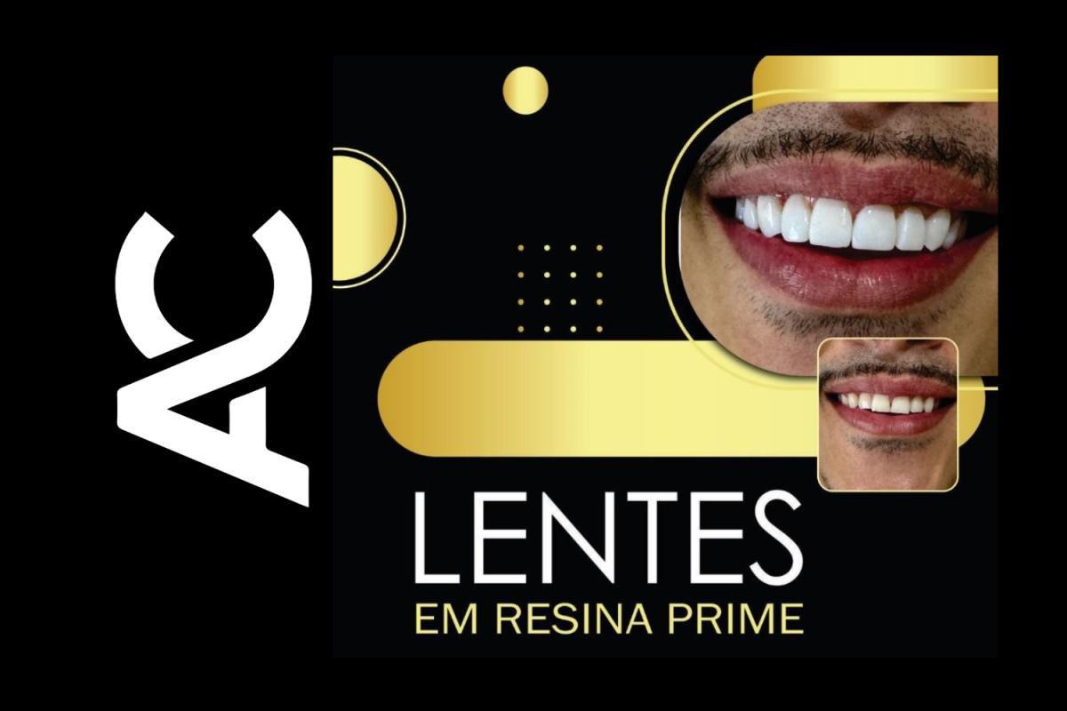  Lentes em Resina Prime por R$ 1.600,00