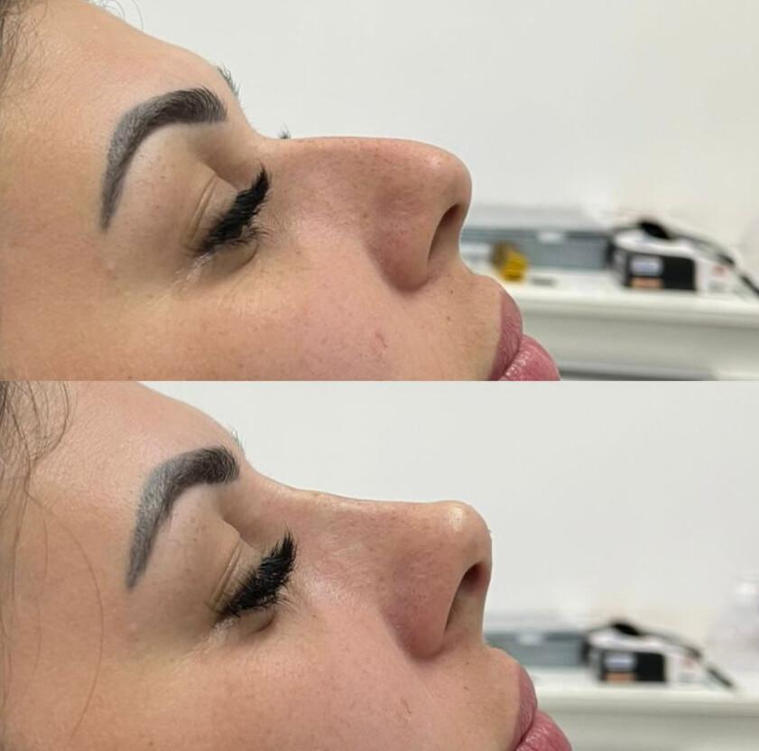 Milene Krebs - Odontologia e Estética Milene Krebs - Odontologia e Estética