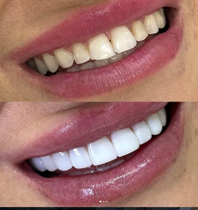 Milene Krebs - Odontologia e Estética Milene Krebs - Odontologia e Estética