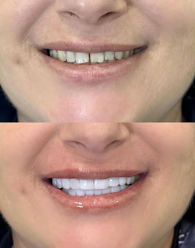 Milene Krebs - Odontologia e Estética Milene Krebs - Odontologia e Estética