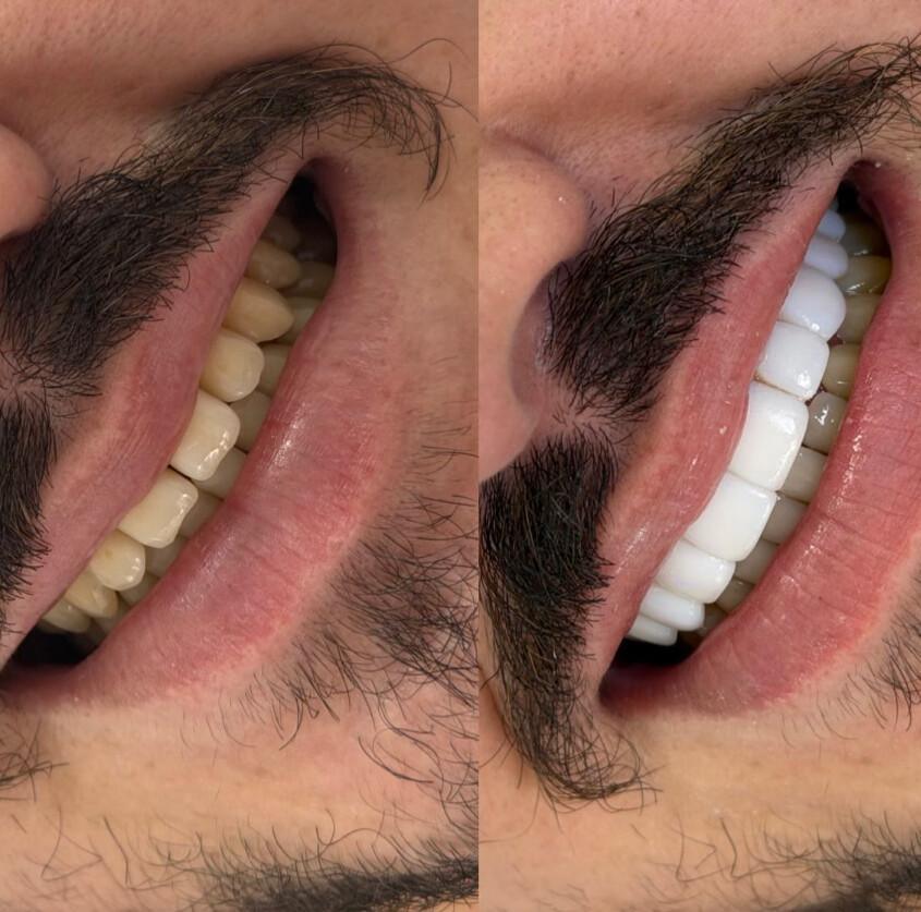 Milene Krebs - Odontologia e Estética Milene Krebs - Odontologia e Estética