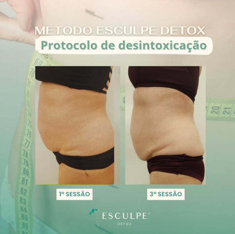 Emagrecentro Gravataí Emagrecentro Gravataí