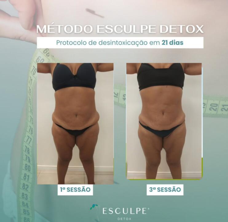 Emagrecentro Gravataí Emagrecentro Gravataí