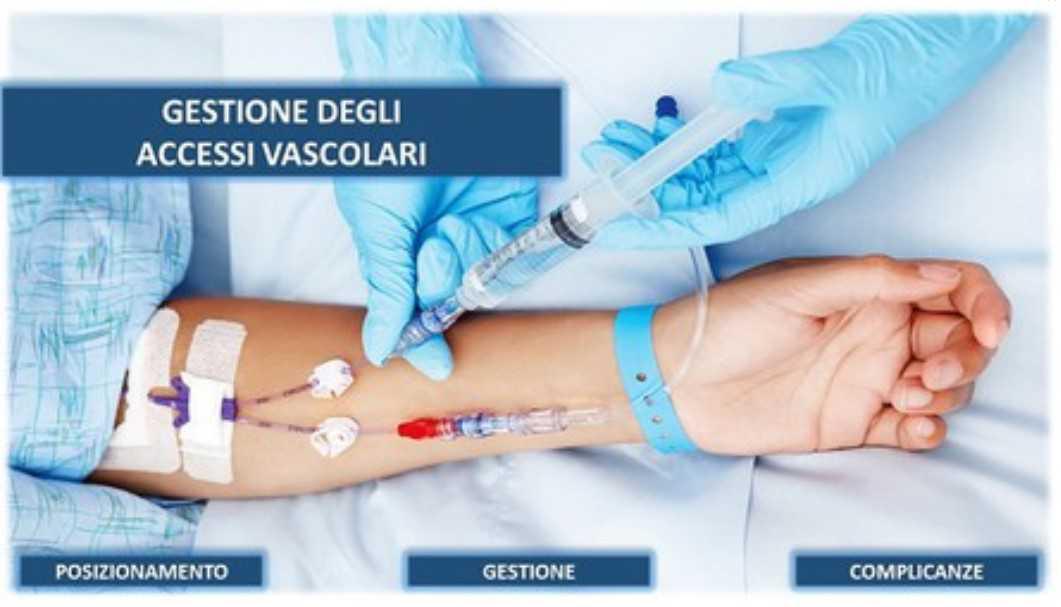 GESTIONE DEGLI ACCESSI VASCOLARI GESTIONE DEGLI ACCESSI VASCOLARI