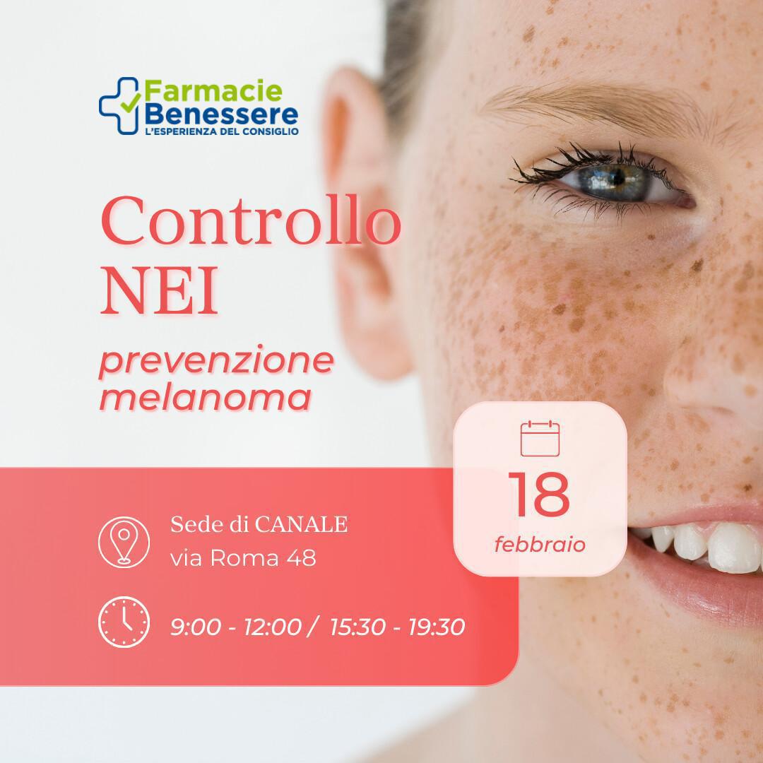 Conosci i tuoi nei? Conosci i tuoi nei?