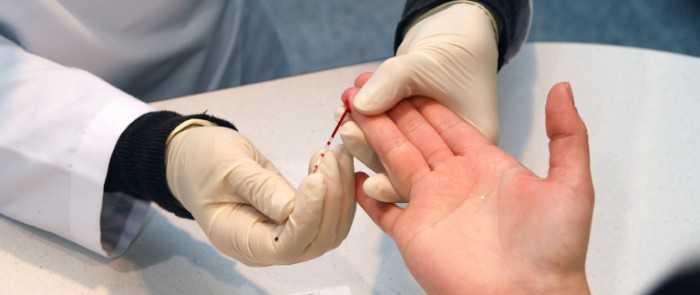 Analisi del sangue Analisi del sangue