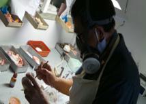 Prix Dentier Ile Maurice - Réponse Du Dr Dupeyrat Gérard Stomatologue Implantologue À Paris 75008.