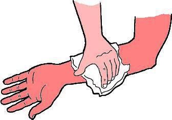 Hémorragie Hémorragie