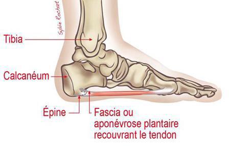 Un pied, même un pied de Gaëlle SKRELA, ça ressemble à ça