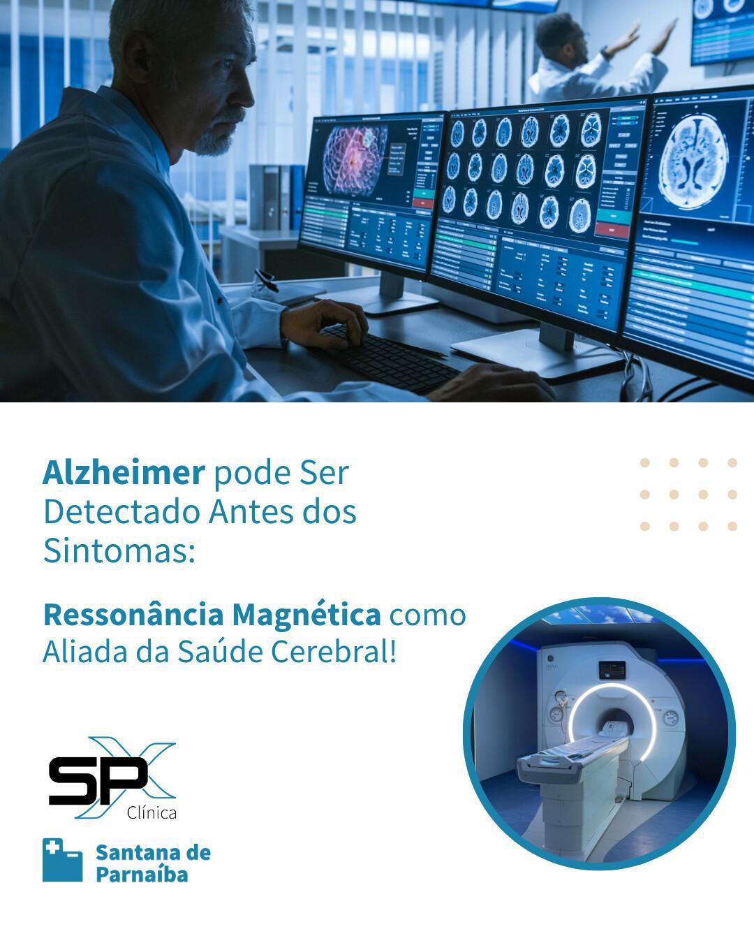 🧠 Alzheimer pode Ser Detectado Antes dos Sintomas: Ressonância Magnética como Aliada da Saúde Cerebral! 🔎