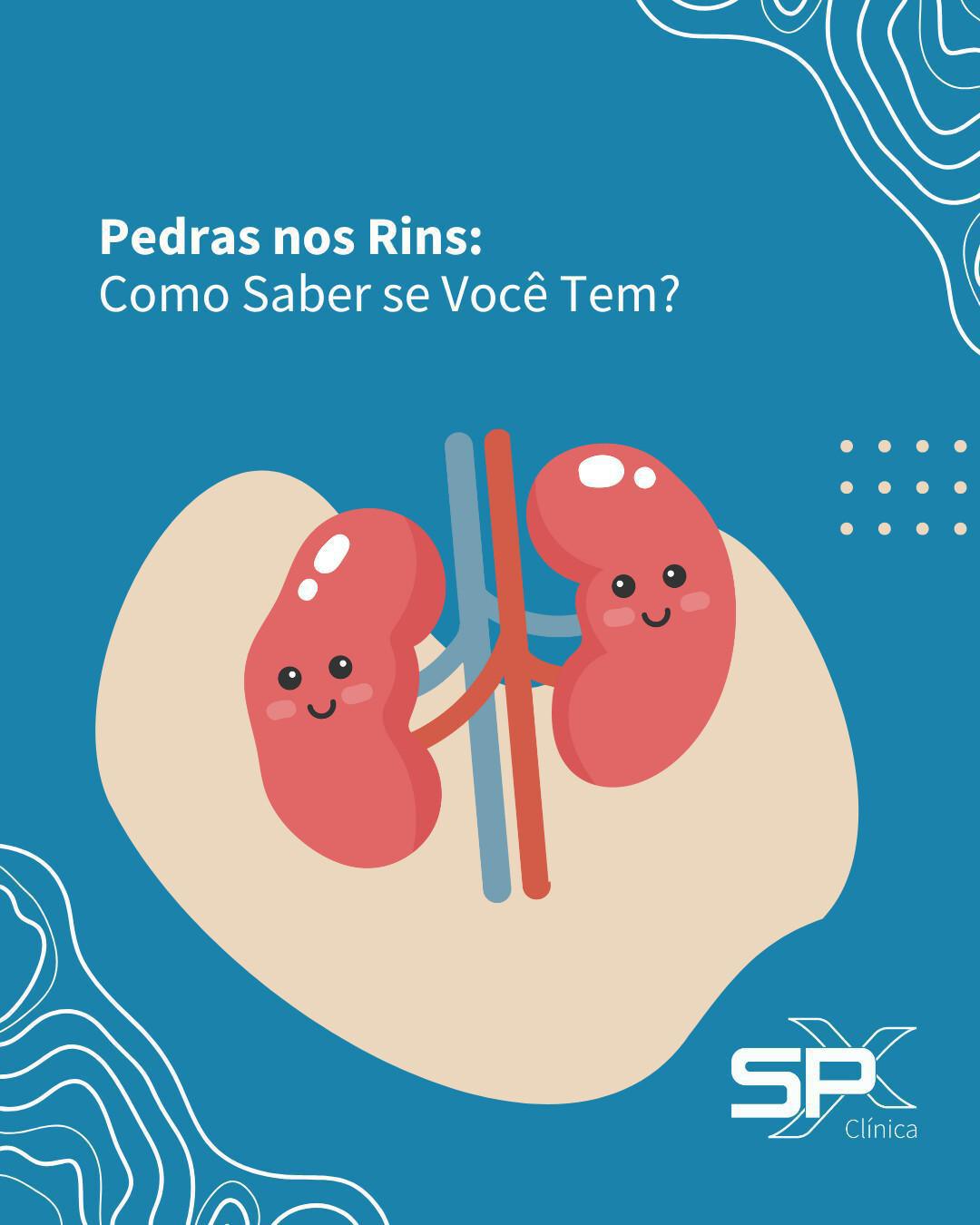 😖 Pedras nos Rins: Como Saber se Você Tem? 🚨