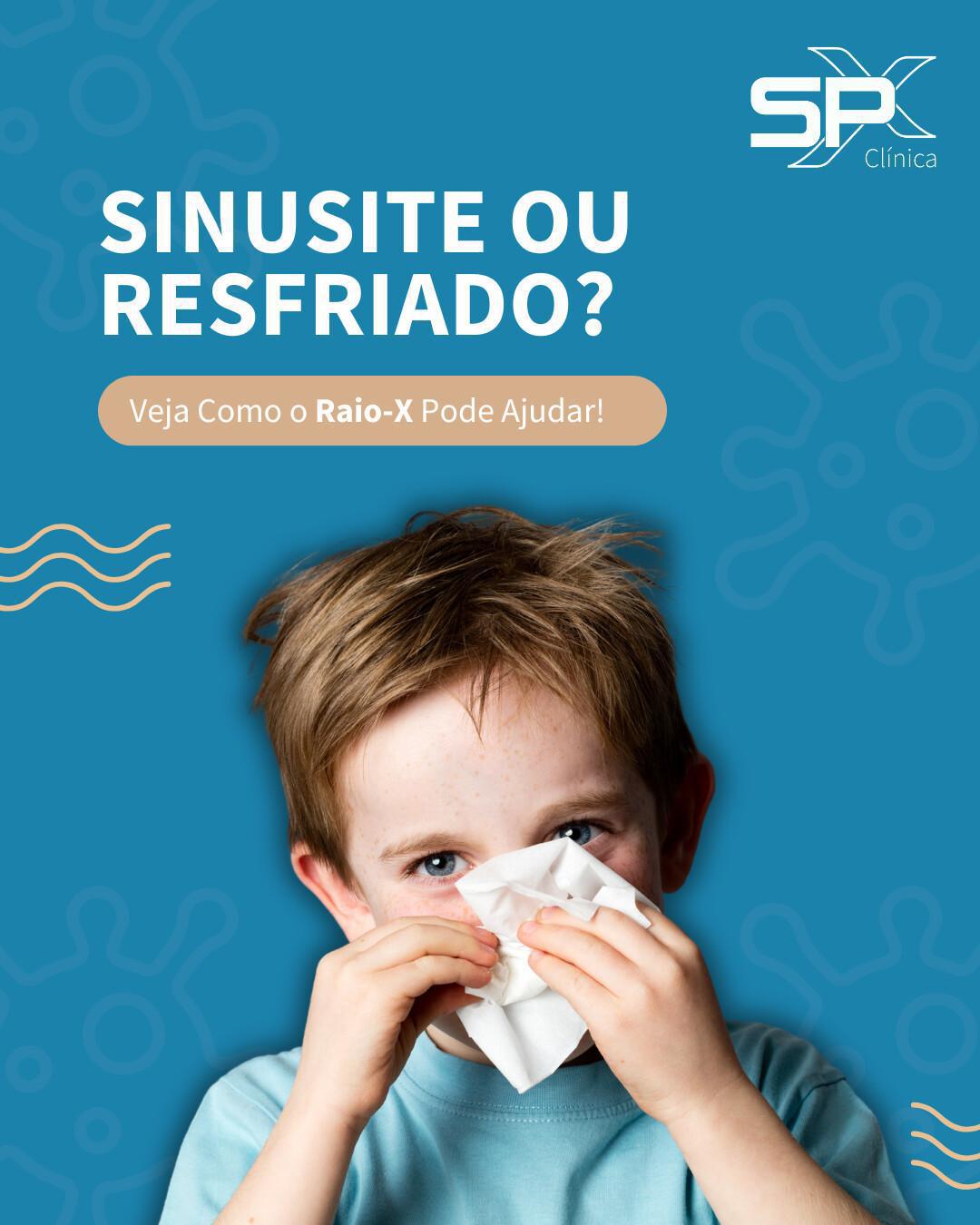 🤧 Sinusite ou Resfriado? Veja Como o Raio-X Pode Ajudar! 🔎