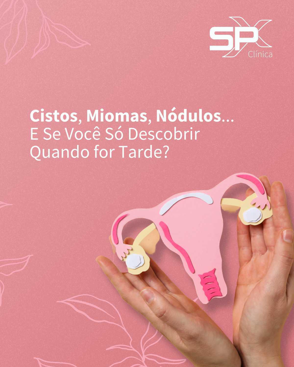  🔎 Cistos, Miomas, Nódulos... E Se Você Só Descobrir Quando for Tarde? 😟