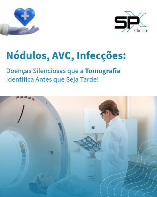  😷 Nódulos, AVC, Infecções: Doenças Silenciosas que a Tomografia Identifica Antes que Seja Tarde 🔎