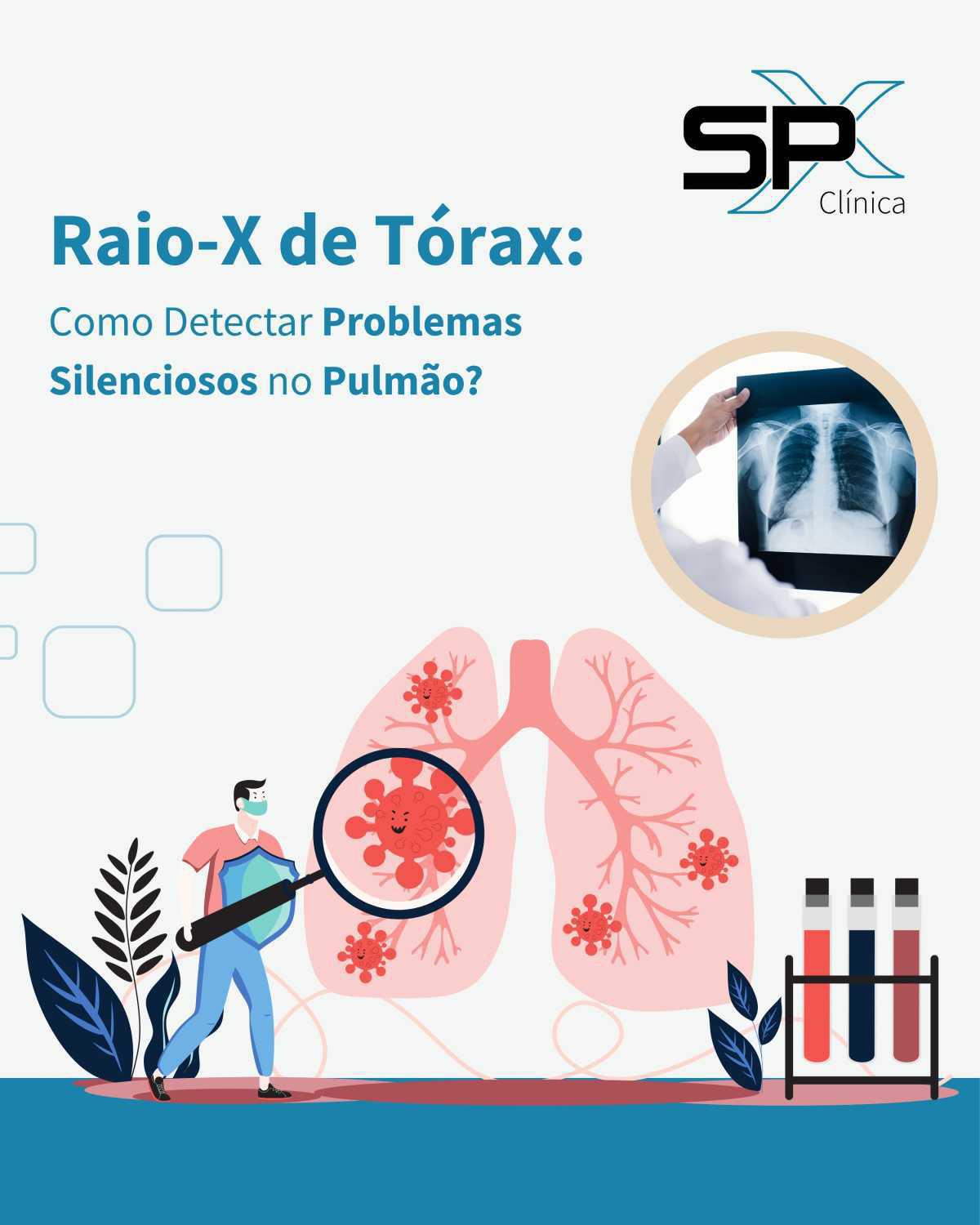 🔬 Raio-X de Tórax: Como Detectar Problemas Silenciosos no Pulmão? 🔍
