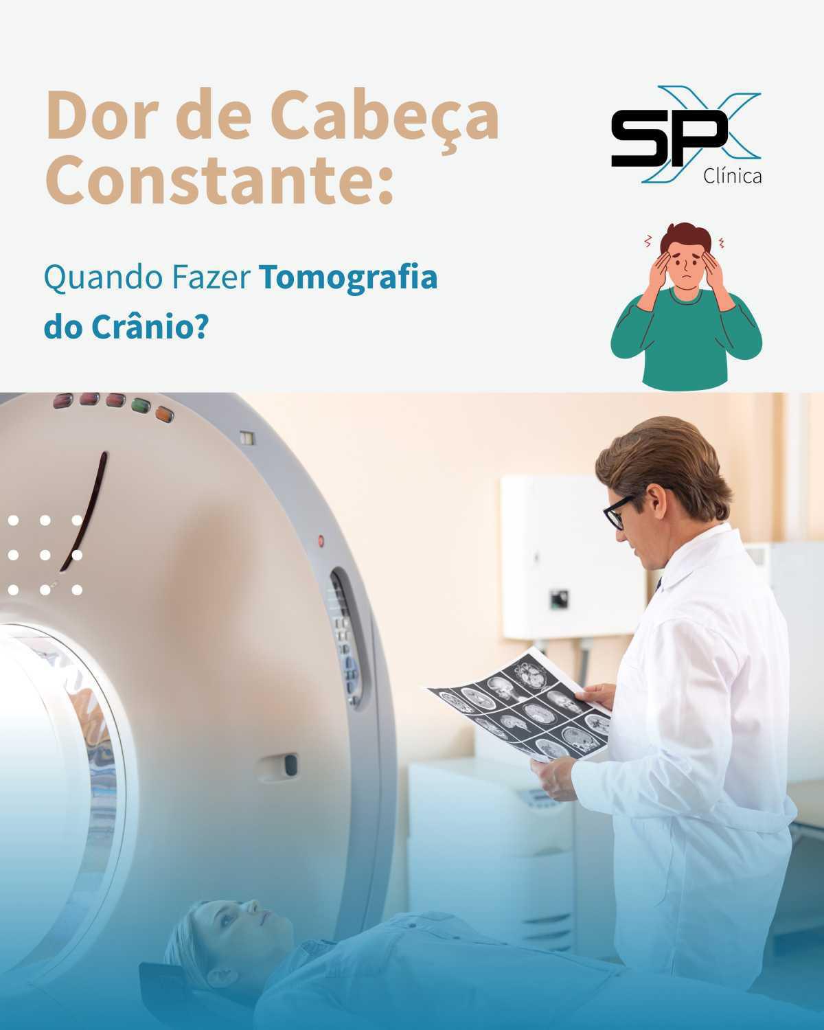 🤕 Dor de Cabeça Constante: Quando Fazer Tomografia do Crânio? 🔎