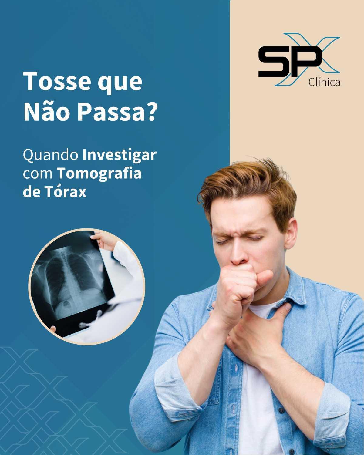 😷 Tosse que Não Passa? Quando Investigar com Tomografia de Tórax 🔎