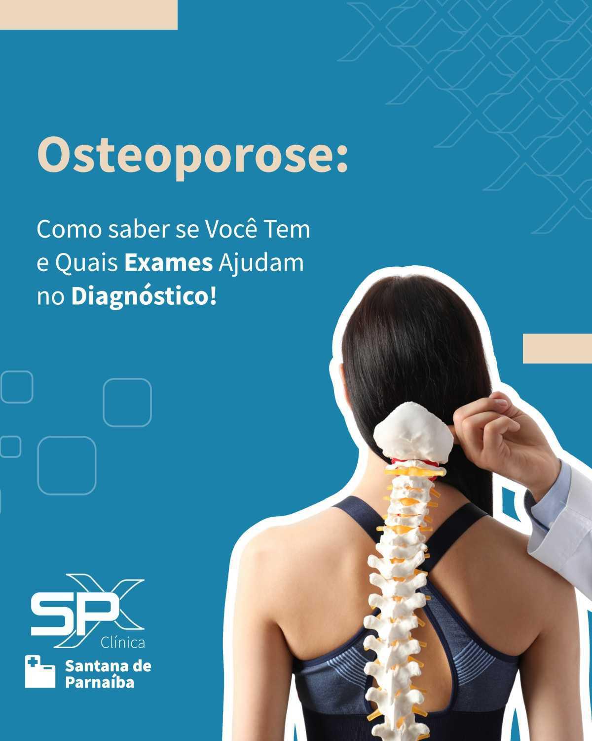 💥 Osteoporose: Como saber se Você Tem e Quais Exames Ajudam no Diagnóstico! 🔎