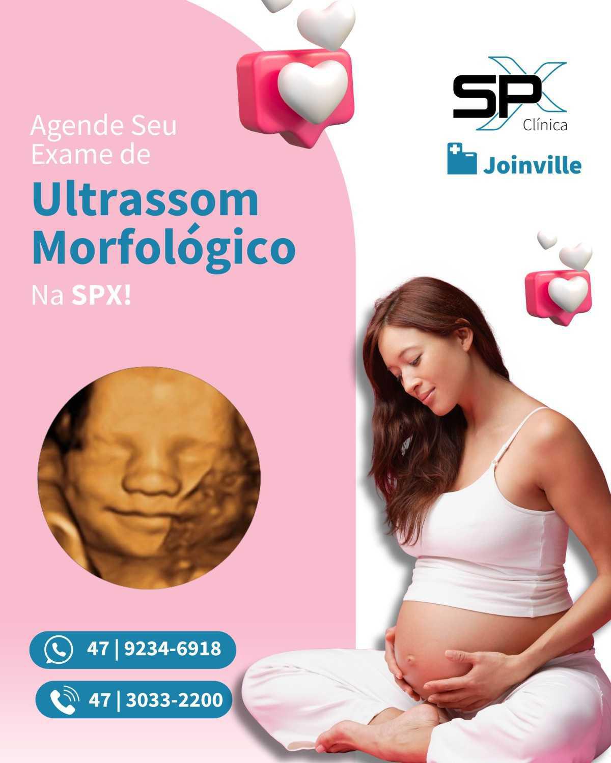 💖 Você e Seu Bebê Merecem o Melhor: Agende Seu Exame de Ultrassom Morfológico! 👶🏻