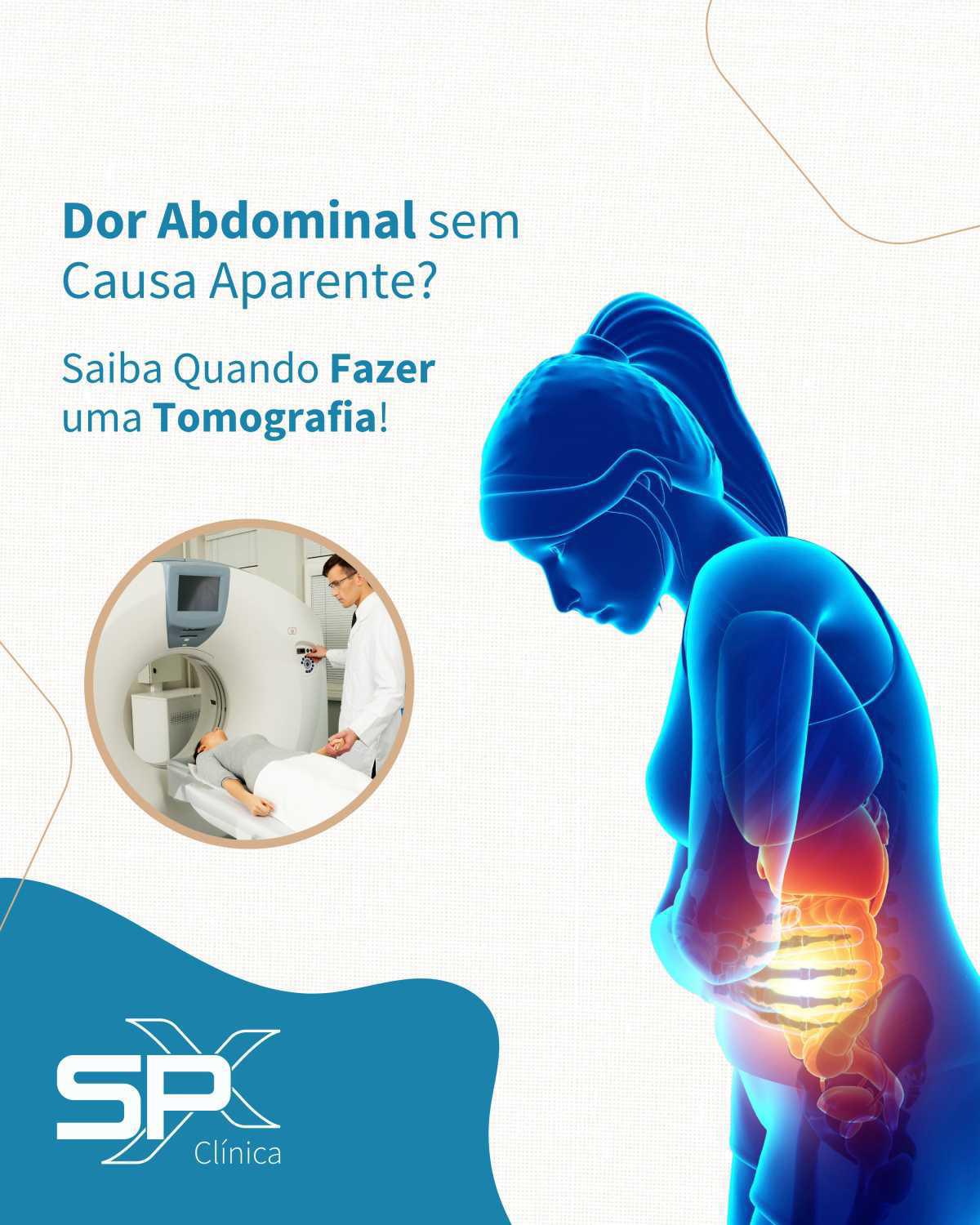 😣 Dor Abdominal sem Causa Aparente? Saiba Quando Fazer uma Tomografia 🔎