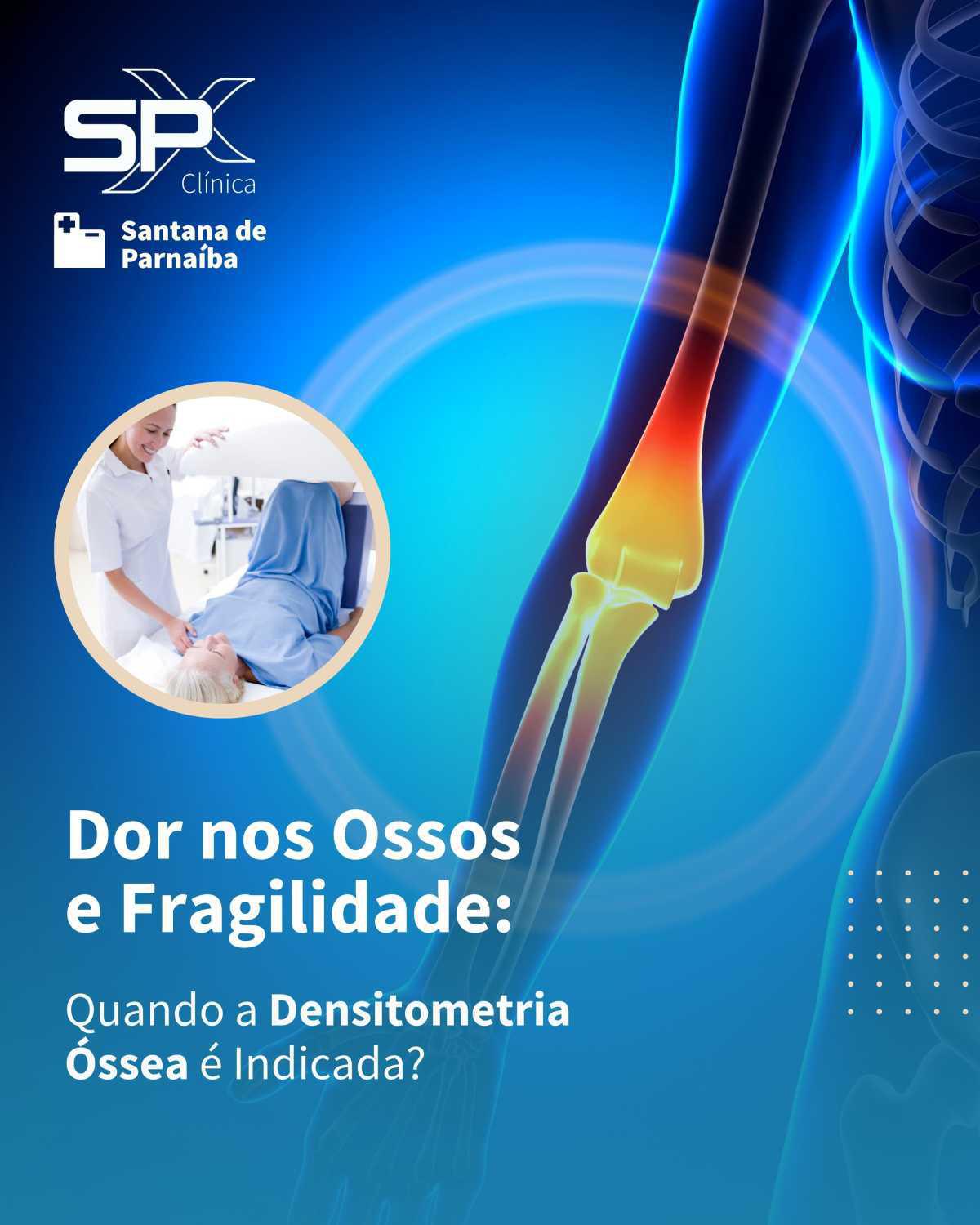 💥 Dor nos Ossos e Fragilidade: Quando a Densitometria Óssea é Indicada? 🔎