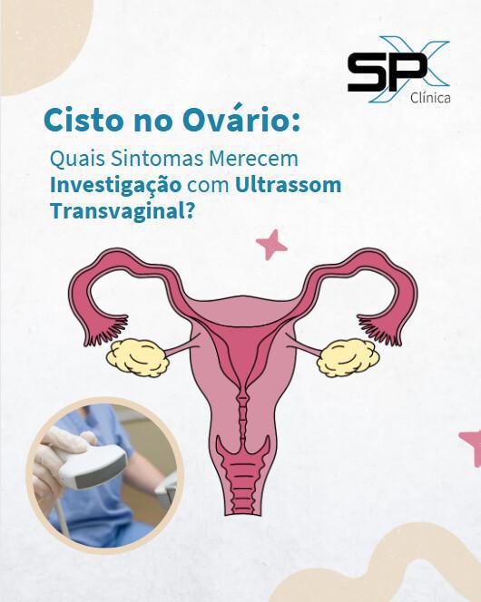 🌸 Cisto no Ovário: Quais Sintomas Merecem Investigação com Ultrassom Transvaginal? 🔎