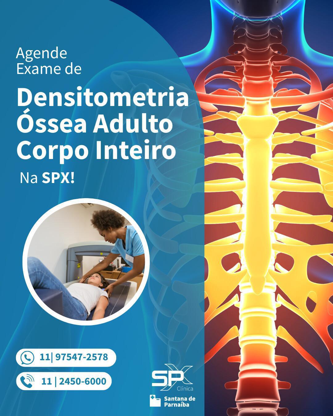🔎 Densitometria Óssea do Corpo Inteiro para Adultos: Novidade na SPX Santana de Parnaíba! 😍
