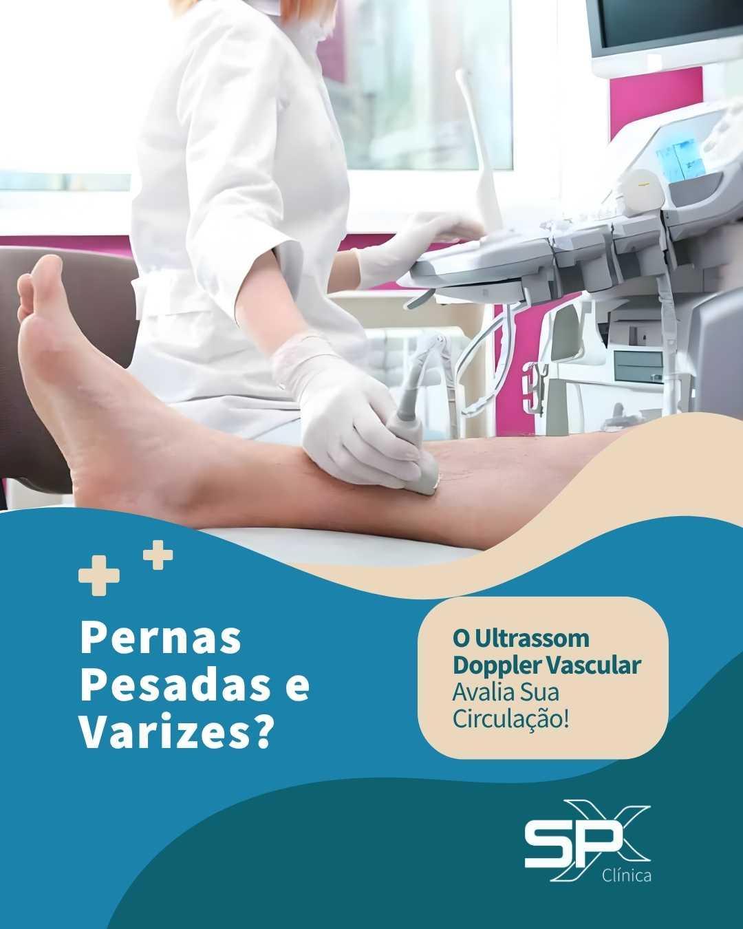 🦵🏻 Pernas Pesadas e Varizes? O Ultrassom Doppler Vascular Avalia Sua Circulação! 🔎
