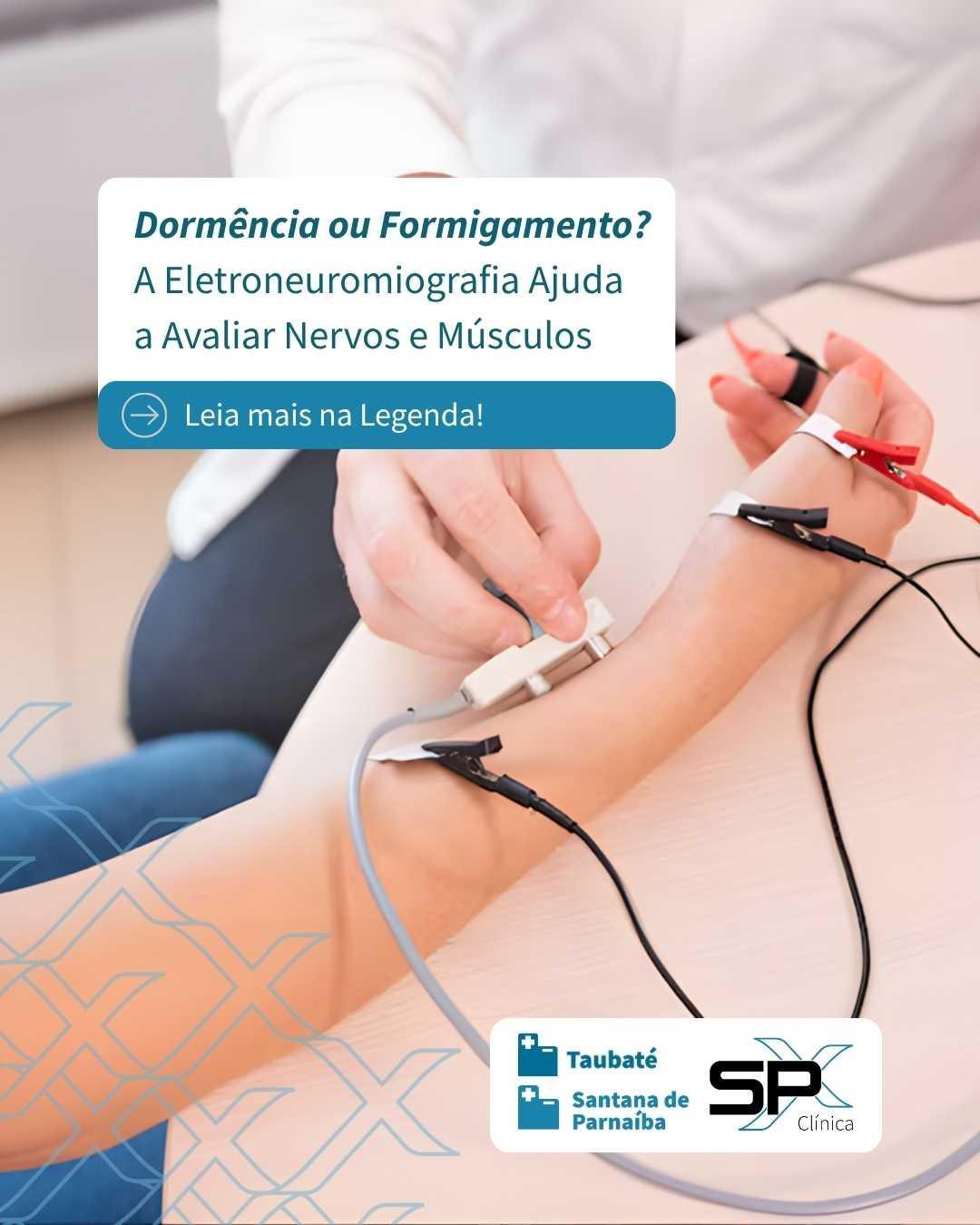 😖 Dormência ou Formigamento? A Eletroneuromiografia Ajuda a Avaliar Nervos e Músculos ⚡