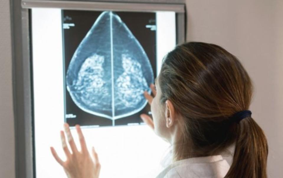 IA : Recherche sur le cancer  IA : Recherche sur le cancer