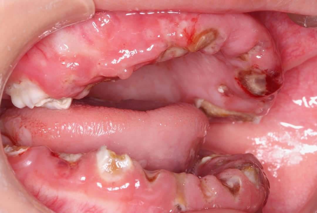 ORTOPEDIA DENTOFACIAL  ORTOPEDIA DENTOFACIAL