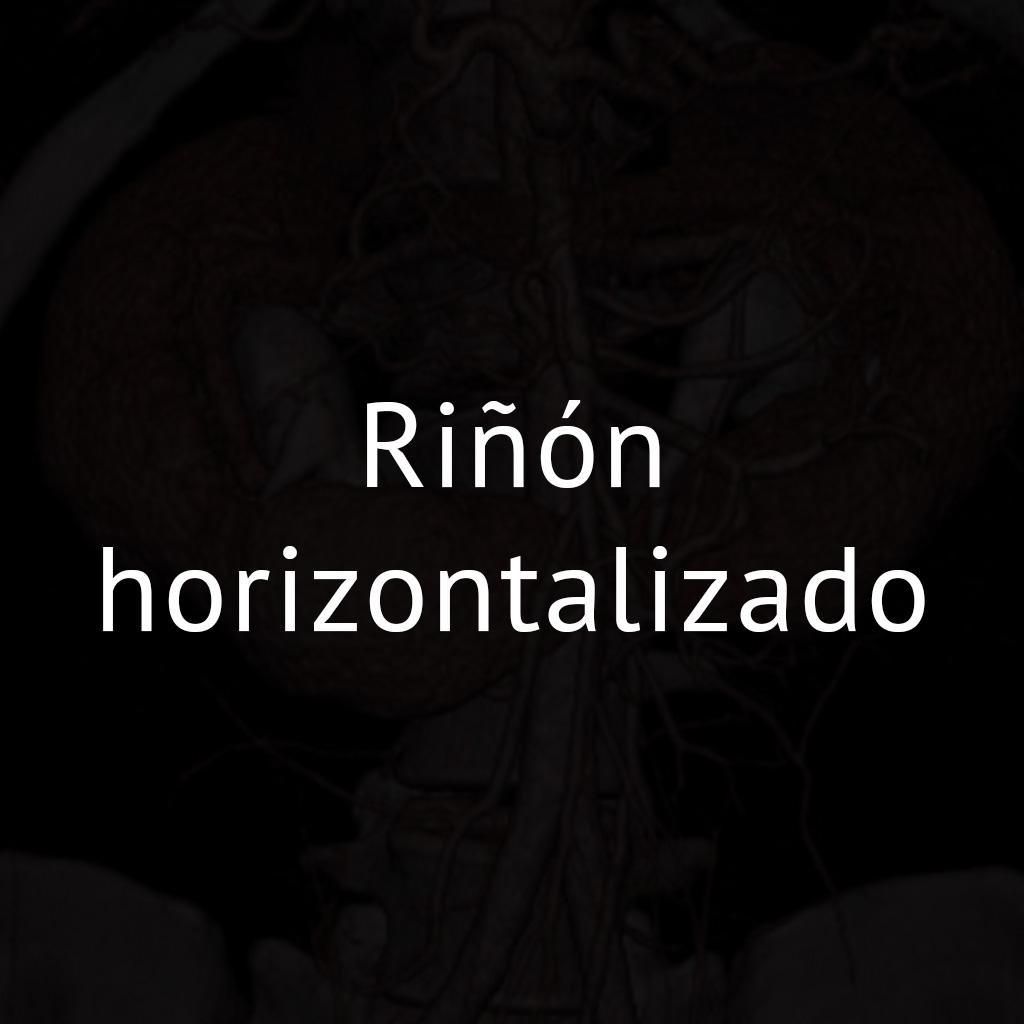 Riñón horizontalizado
