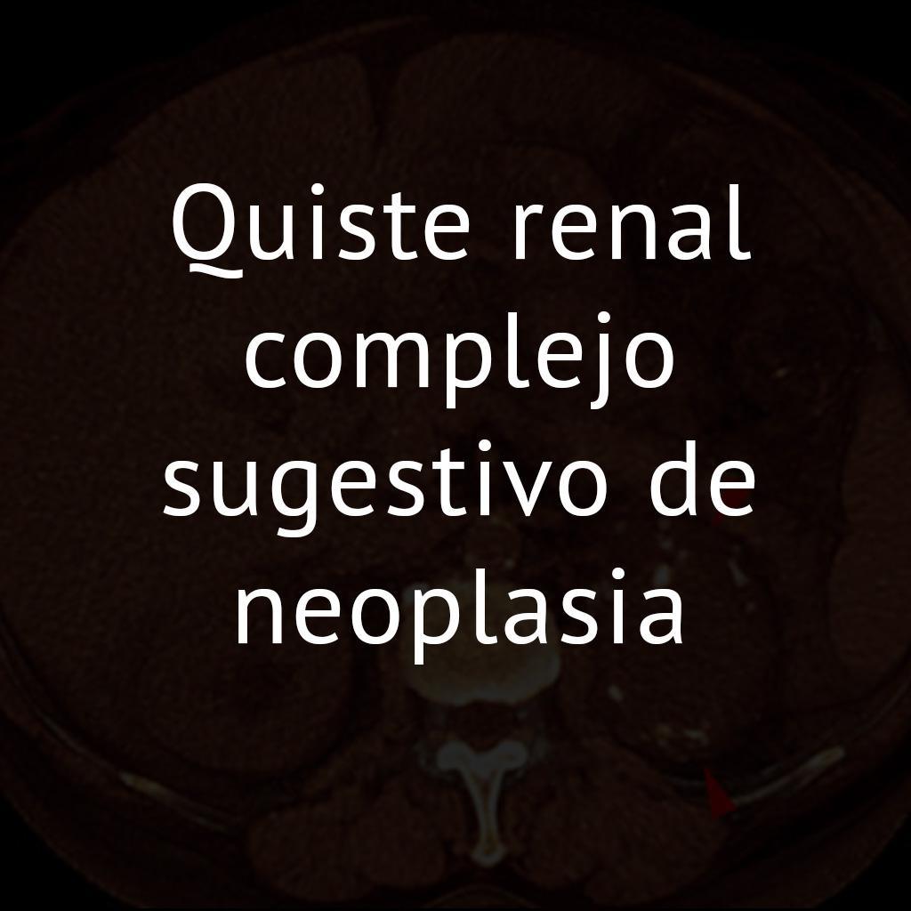 Quiste renal complejo sugestivo de neoplasia