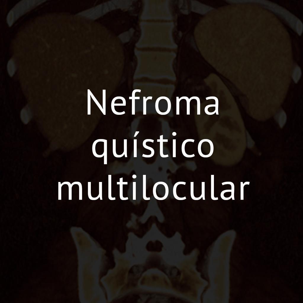 Nefroma quístico multilocular