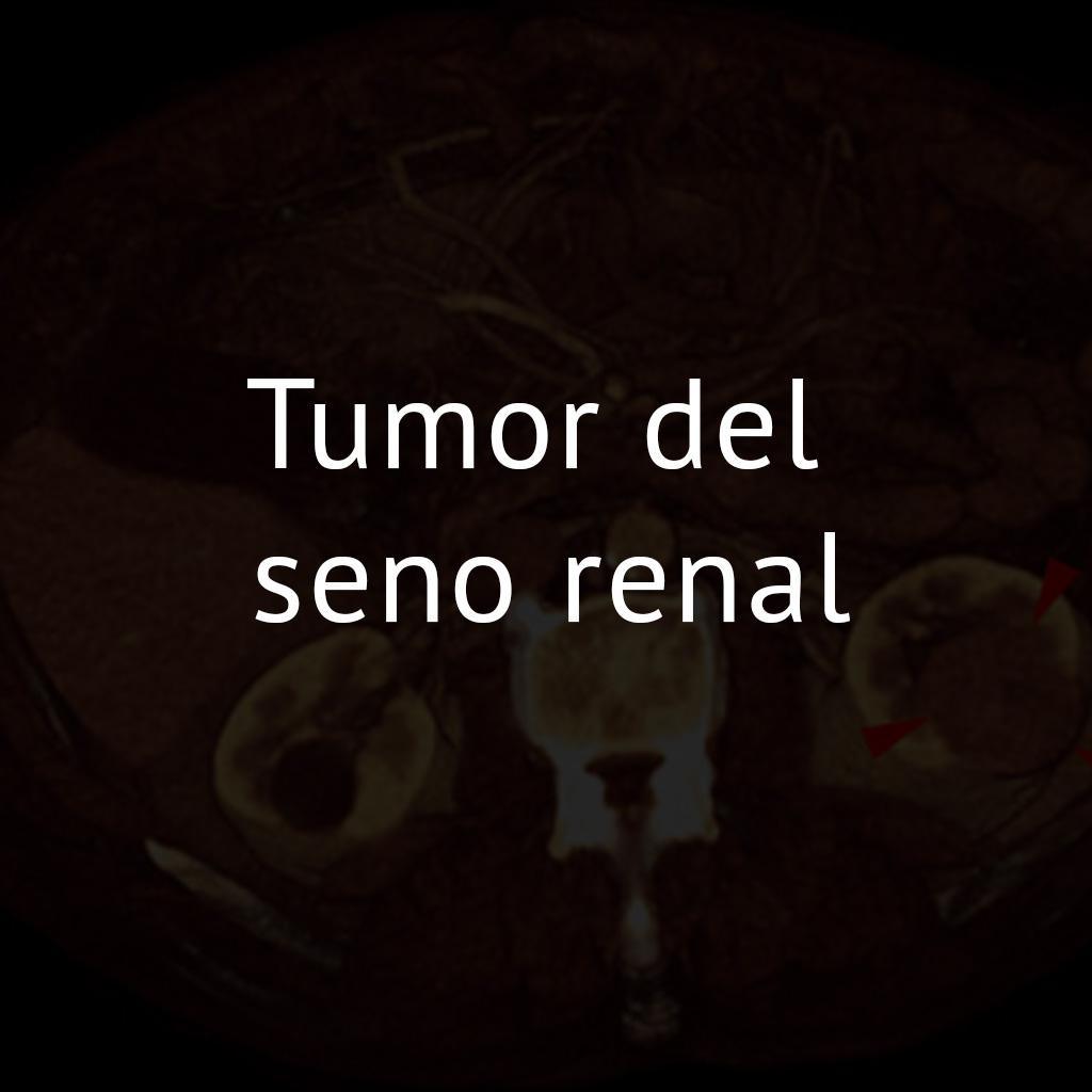 Tumor del seno renal