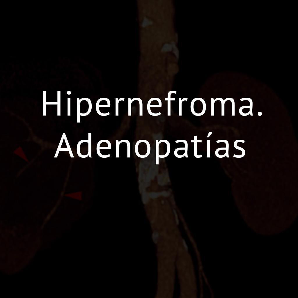 Hipernefroma. Adenopatías