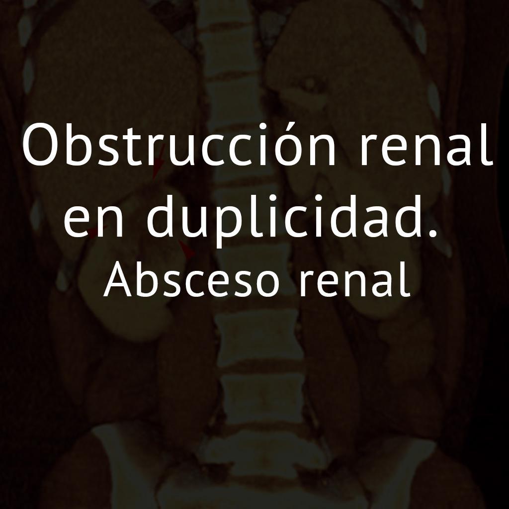 Obstrucción renal en duplicidad. Absceso renal