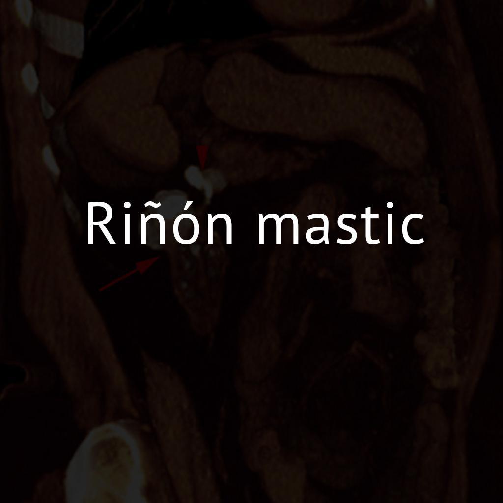 Riñón mastic