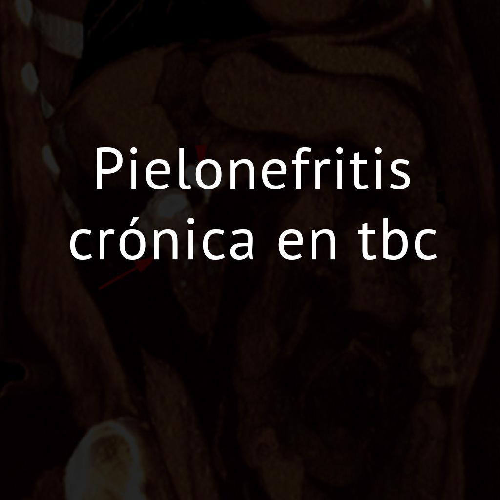 Pielonefritis crónica en tbc